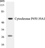 IGSF4C Polyclonal Antibody