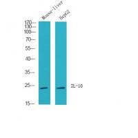 IL-10 Polyclonal Antibody