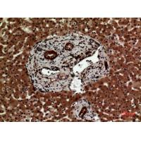 IL-12A p35 Polyclonal Antibody