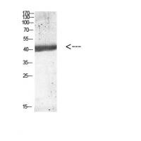 IL-12B p40 Polyclonal Antibody