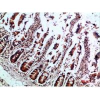 IL-12B p40 Polyclonal Antibody