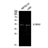 IL-13Rα2 Polyclonal Antibody