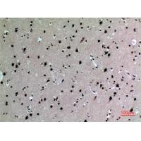 IL-16 Polyclonal Antibody