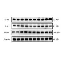 IL-18R Polyclonal Antibody