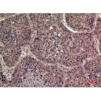 IL-1F8 Polyclonal Antibody