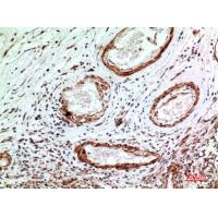 IL-1RI Polyclonal Antibody