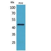 IL-1RII Polyclonal Antibody