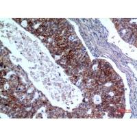 IL-1RII Polyclonal Antibody