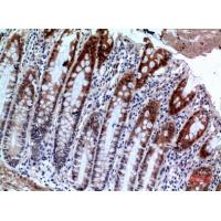 IL-1RII Polyclonal Antibody
