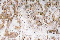 IL-1α Polyclonal Antibody