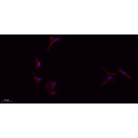 IL-1β Polyclonal Antibody
