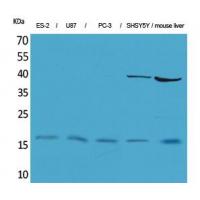 IL-1β Polyclonal Antibody