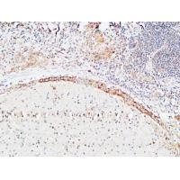 IL-1β Polyclonal Antibody