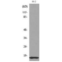IL-1β Polyclonal Antibody