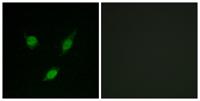 TACC1 Polyclonal Antibody