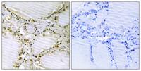 AMPD1 Polyclonal Antibody