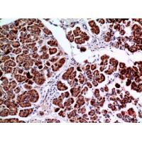 Amphiphysin II Polyclonal Antibody