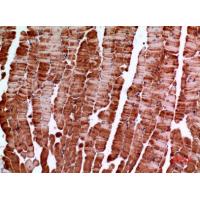 Amphiphysin II Polyclonal Antibody