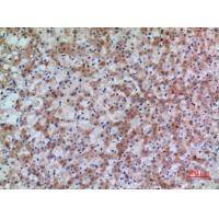 17β-HSD4 Polyclonal Antibody