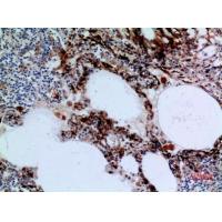 17β-HSD4 Polyclonal Antibody