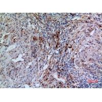 17β-HSD4 Polyclonal Antibody