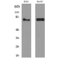 17β-HSD4 Polyclonal Antibody