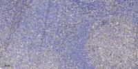 4.1G Polyclonal Antibody