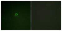 4E-BP1 Polyclonal Antibody