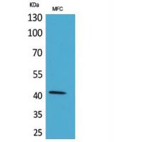 α-SMA Polyclonal Antibody