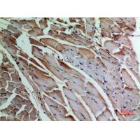 α-SMA Polyclonal Antibody