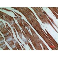 α-SMA Polyclonal Antibody