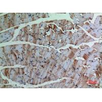 α-SMA Polyclonal Antibody