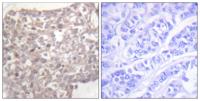 Tubulin γ Polyclonal Antibody