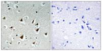ZHX2 Polyclonal Antibody
