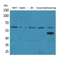 ZKSCAN4 Polyclonal Antibody