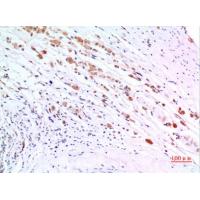 ZKSCAN4 Polyclonal Antibody