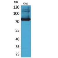 Transferrin Polyclonal Antibody