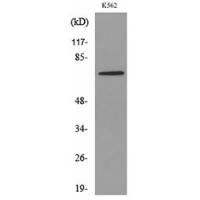 Transferrin Polyclonal Antibody