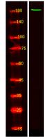 ZNF262 Polyclonal Antibody
