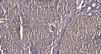 ZNF337 Polyclonal Antibody