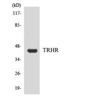TRH-R1 Polyclonal Antibody