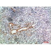 TRIF Polyclonal Antibody