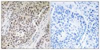 ZNF608 Polyclonal Antibody
