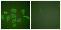 Trk A Polyclonal Antibody