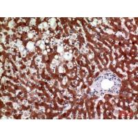 11β-HSD1 Polyclonal Antibody