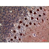 11β-HSD1 Polyclonal Antibody