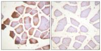 Troponin I-C Polyclonal Antibody