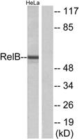 RelB Polyclonal Antibody