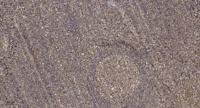 RelB Polyclonal Antibody