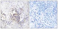 REP-2 Polyclonal Antibody